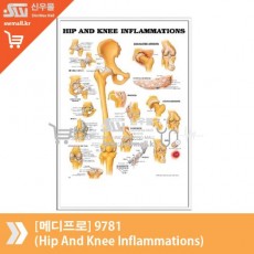 [메디프로]9781(Hip And Knee Inflammations)